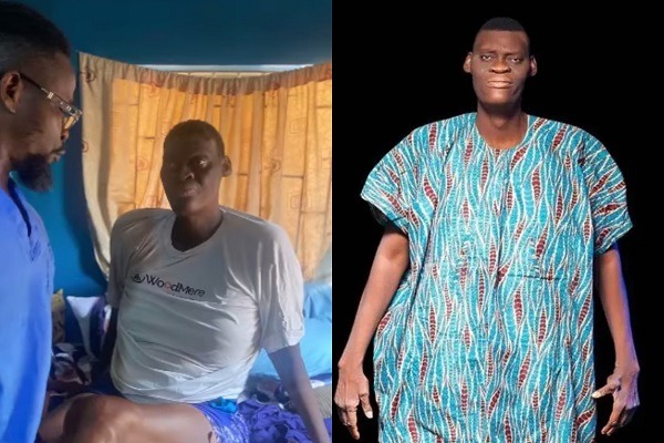 Tallest Man in Nigeria dies of gigantism